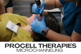 Procell Therapies - Microchanneling