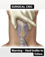 Surgical Cric