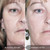 Mirenesse - Skin Refining Midnight Magic Cell Serum With 100% Actives Mini + Free Mini