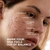 Skin Centrick - Acne Face Cleanser - Advanced Formula with Niacinamide, Purifying Clay, and Salicylic Acid