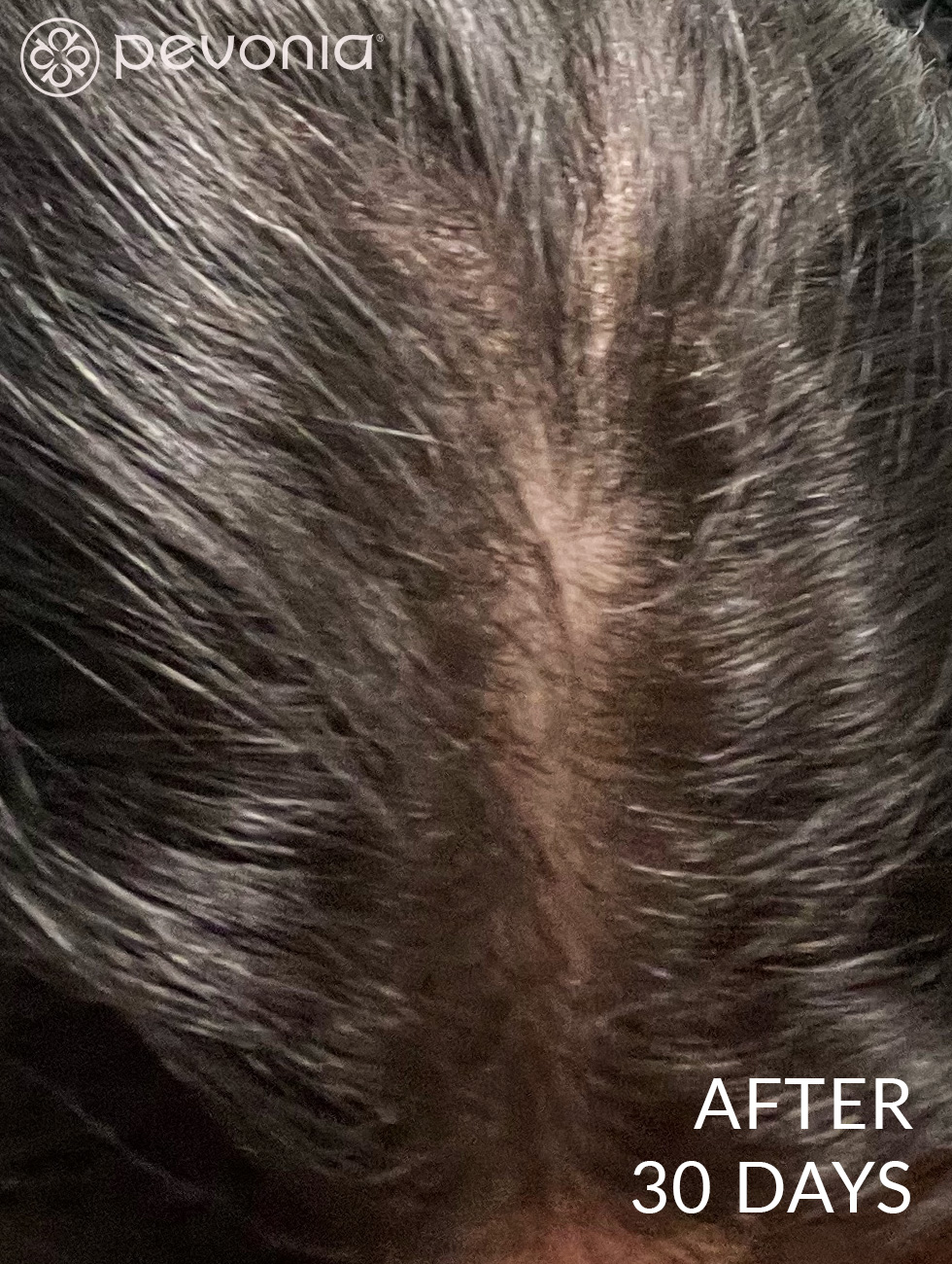 Thicker hair after using Hair Energize Extra-Strength Line Daily for 30 Days