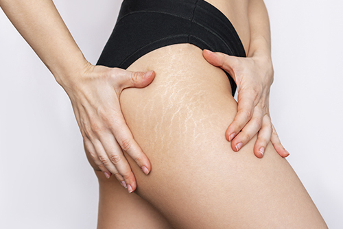 Deshabituación tabáquica en Farmacia Bonnin, en Palma de Mallorca