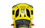 Scalextric Aston Martin GT3 Vantage – Penny Homes Racing – Ronan Murphy 1/32 Slot Car
