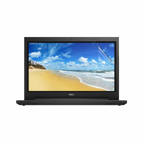 Dell Inspiron 15 3555 (Touch) Vivid Screen Protector