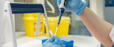 The Ultimate Guide: Micropipette vs. Pipette