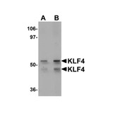 ProSci 5603 KLF4 Antibody