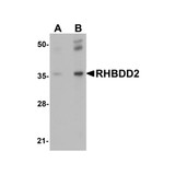ProSci 5527 RHBDD2 Antibody
