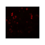 ProSci 5743 PIAS2 Antibody