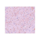ProSci 5743 PIAS2 Antibody