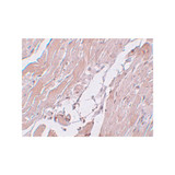 ProSci 5511 CCDC47 Antibody