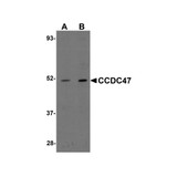 ProSci 5511 CCDC47 Antibody