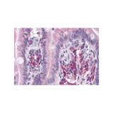 ProSci 5451 VARP Antibody