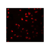 ProSci 5589 ARHGAP18 Antibody