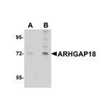 ProSci 5589 ARHGAP18 Antibody