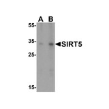 ProSci 5771 SIRT5 Antibody