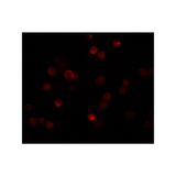 ProSci 5859 CaBP7 Antibody