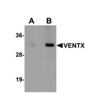 ProSci 5863 VENTX Antibody