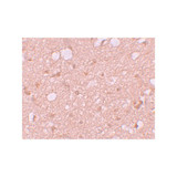 ProSci 5877 SESTD1 Antibody