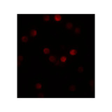 ProSci 5823 SIP1 Antibody