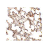 ProSci 6451 Coronin 7 Antibody