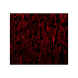 ProSci 6495 RILPL1 Antibody