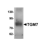 ProSci 6541 TGM7 Antibody