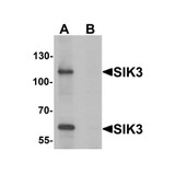 ProSci 6613 SIK3 Antibody