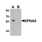 ProSci 6655 KPNA5 Antibody