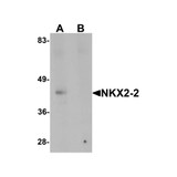 ProSci 6743 NKX2-2 Antibody