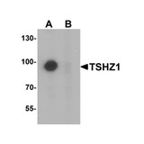 ProSci 6755 TSHZ1 Antibody