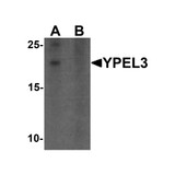 ProSci 6775 YPEL3 Antibody