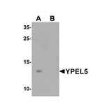 ProSci 6779 YPEL5 Antibody