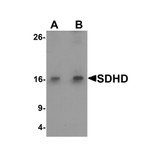 ProSci 6847 SDHD Antibody