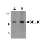 ProSci 6975 SELK Antibody