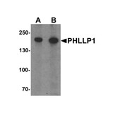 ProSci 7019 PHLPP1 Antibody