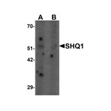 ProSci 7029 SHQ1 Antibody