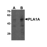 ProSci 7059 PLA1A Antibody
