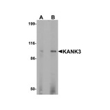 ProSci 7311 KANK3 Antibody
