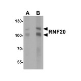 ProSci 7357 RNF20 Antibody