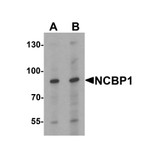 ProSci 7395 NCBP1 Antibody
