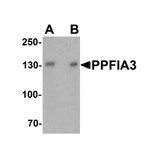 ProSci 7561 PPFIA3 Antibody