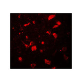 ProSci 7741 OLIG1 Antibody