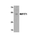 ProSci 7757 IFIT1 Antibody