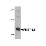 ProSci 7789 FKBP12 Antibody