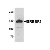 ProSci 7855 SREBF2 Antibody