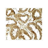 ProSci 7901 HDAC6 Antibody