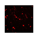 ProSci 7923 NOX2 Antibody