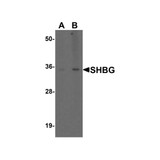 ProSci 7935 SHBG Antibody