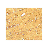 ProSci 7951 MAP1LC3 Antibody