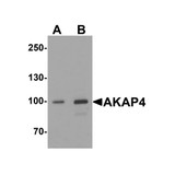 ProSci 7961 AKAP4 Antibody